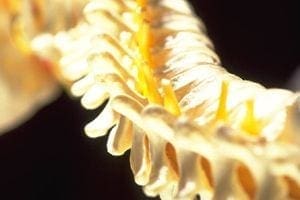 Chiropractic for Scoliosis