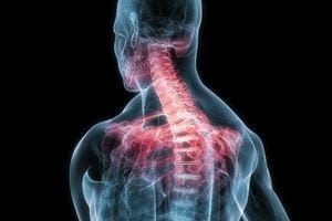 What is Chiropractic Cold Laser Therapy?
