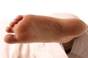 Chiropractic for Plantar Fasciitis