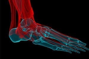 How Chiropractors Help Peripheral Neuropathy