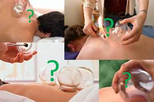 What is Cupping?