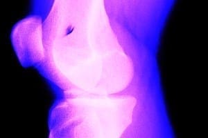 Is It Normal for Knees to Pop and Crack?