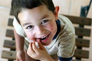 Growth Plate Injuries: What Parents Should Know