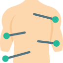 acupuncture acupuncture